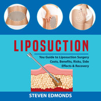 Liposuction: You Guide to Liposuction Surgery Costs, Benefits, Risks, Side Effects & Recovery - Steven Edmonds