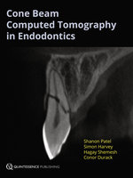 Cone Beam Computed Tomography in Endodontics - Shanon Patel, Hagay Shemesh, Conor Durack, Simon Harvey