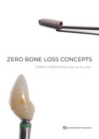 Zero Bone Loss Concepts - Tomas Linkevičius