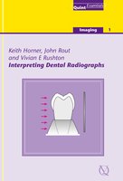 Interpreting Dental Radiographs - Keith Horner, John Rout, Vivian E. Rushton